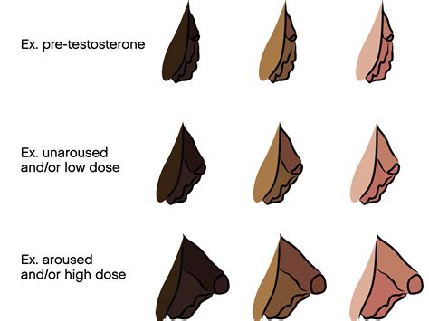 big klitoris|Enlarged Clitoris (Clitoromegaly): Causes & Treatment